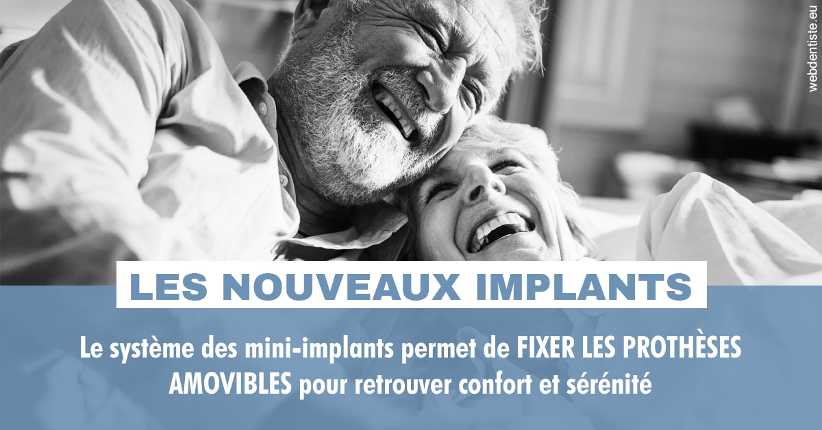 https://dr-courtois-roland.chirurgiens-dentistes.fr/Les nouveaux implants 2