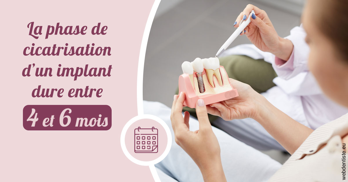 https://dr-courtois-roland.chirurgiens-dentistes.fr/Cicatrisation implant 2