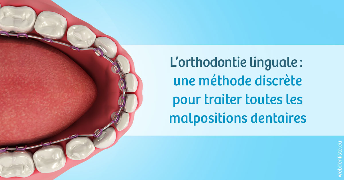 https://dr-courtois-roland.chirurgiens-dentistes.fr/L'orthodontie linguale 1