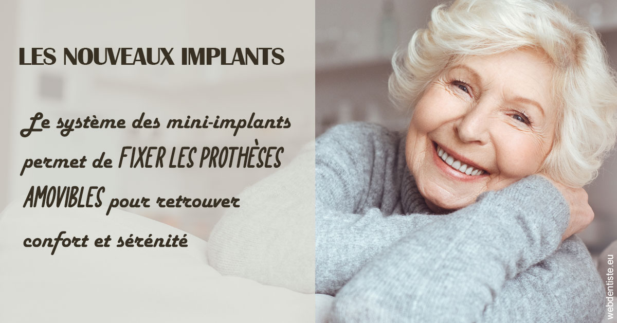 https://dr-courtois-roland.chirurgiens-dentistes.fr/Les nouveaux implants 1