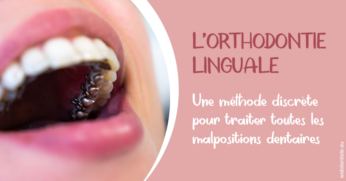 https://dr-courtois-roland.chirurgiens-dentistes.fr/L'orthodontie linguale 2