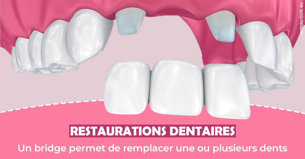 https://dr-courtois-roland.chirurgiens-dentistes.fr/Bridge remplacer dents 2