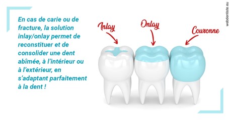 https://dr-courtois-roland.chirurgiens-dentistes.fr/L'INLAY ou l'ONLAY