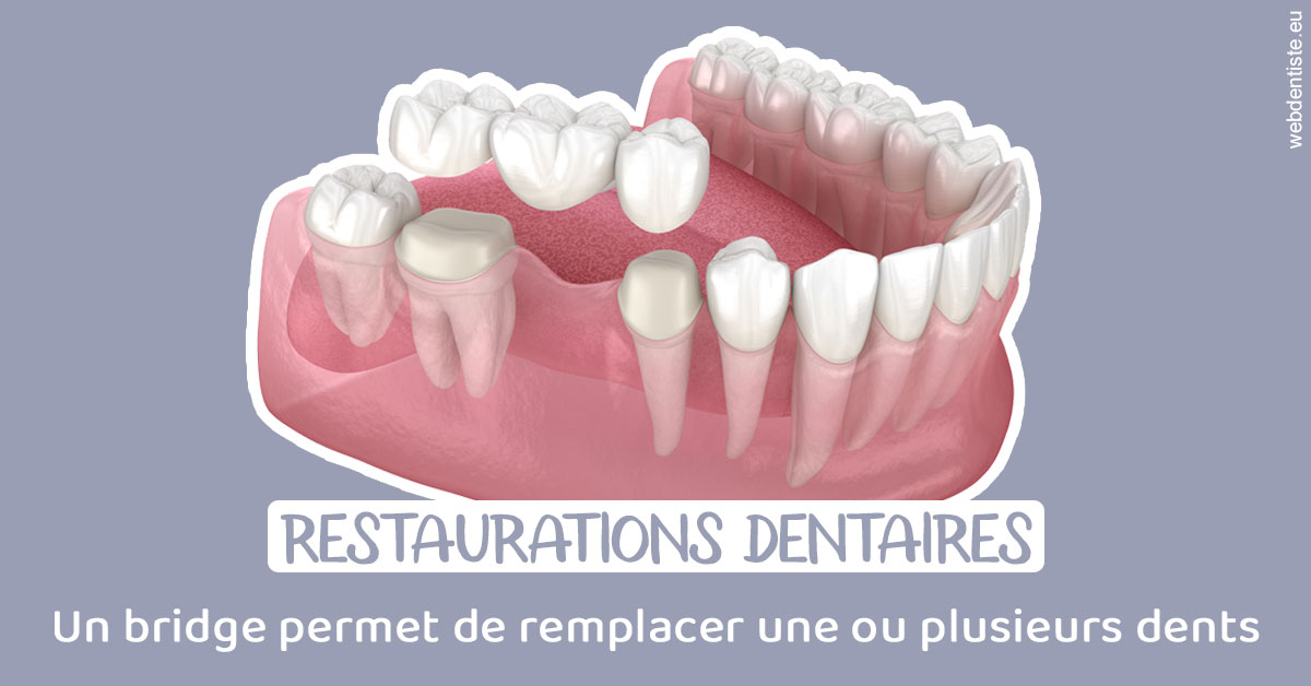 https://dr-courtois-roland.chirurgiens-dentistes.fr/Bridge remplacer dents 1