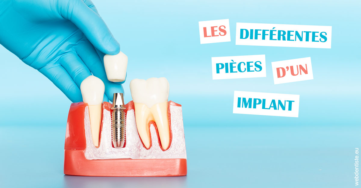 https://dr-courtois-roland.chirurgiens-dentistes.fr/Les différentes pièces d’un implant 2