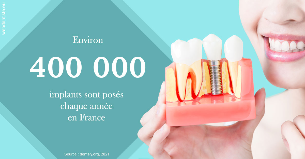https://dr-courtois-roland.chirurgiens-dentistes.fr/Pose d'implants en France 2