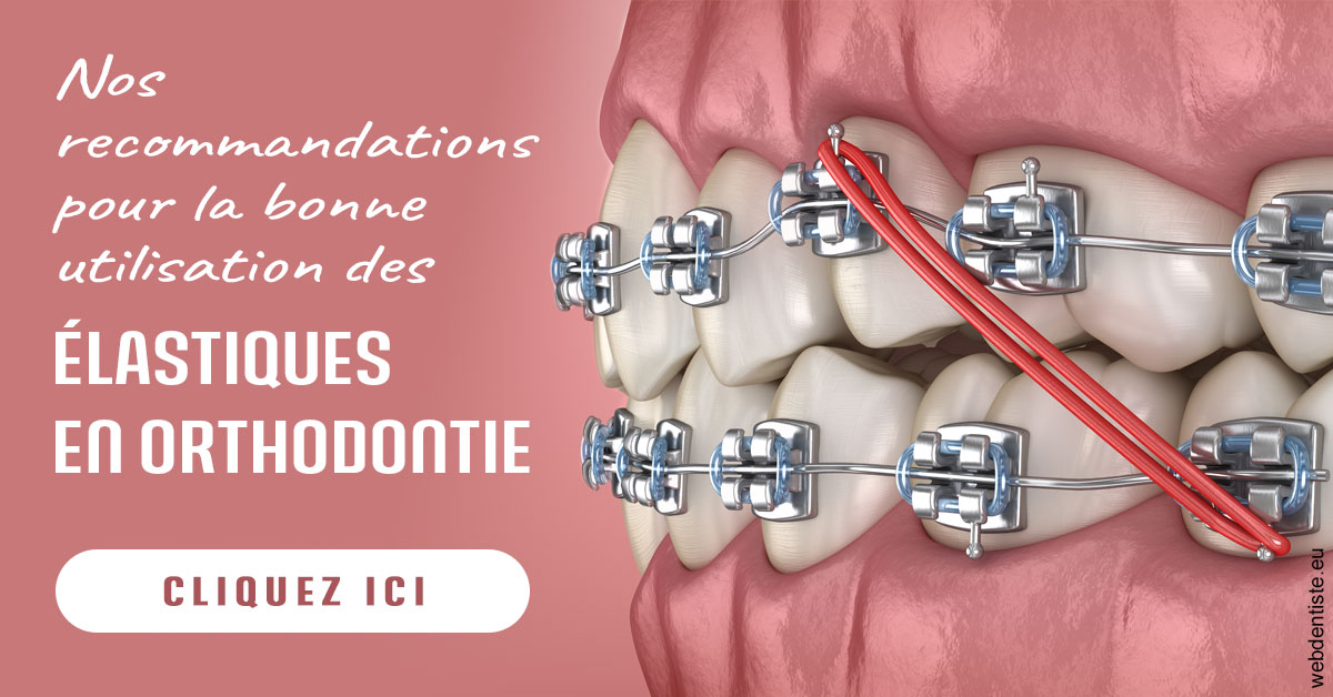 https://dr-courtois-roland.chirurgiens-dentistes.fr/Elastiques orthodontie 2